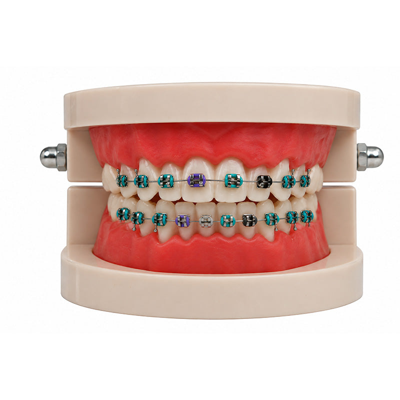 Leone Roth / MBT Midi / Mini Orthodontic Brackets – High-Precision Metal Brackets