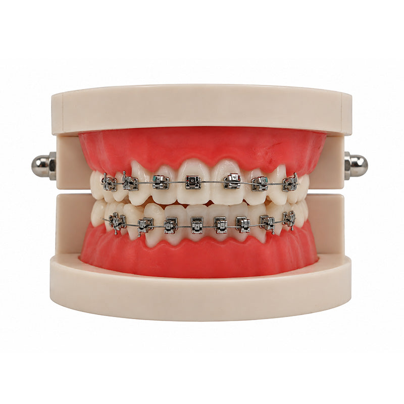Fox SLB Passive B-Series MBT 022 metal brackets kit showing the sturdy metal brackets and mounting components on a neutral background.