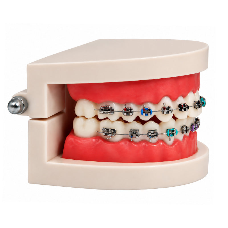 Libral Study Model With Centrino Standard Brackets