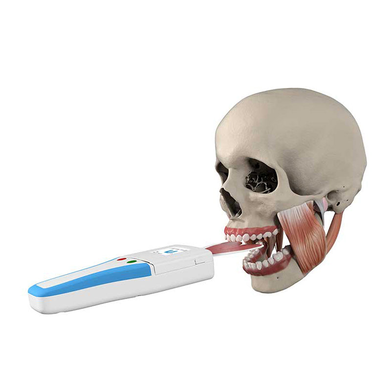Bausch Occlusense Set showing dental occlusion splints and tools for bite alignment and jaw therapy.