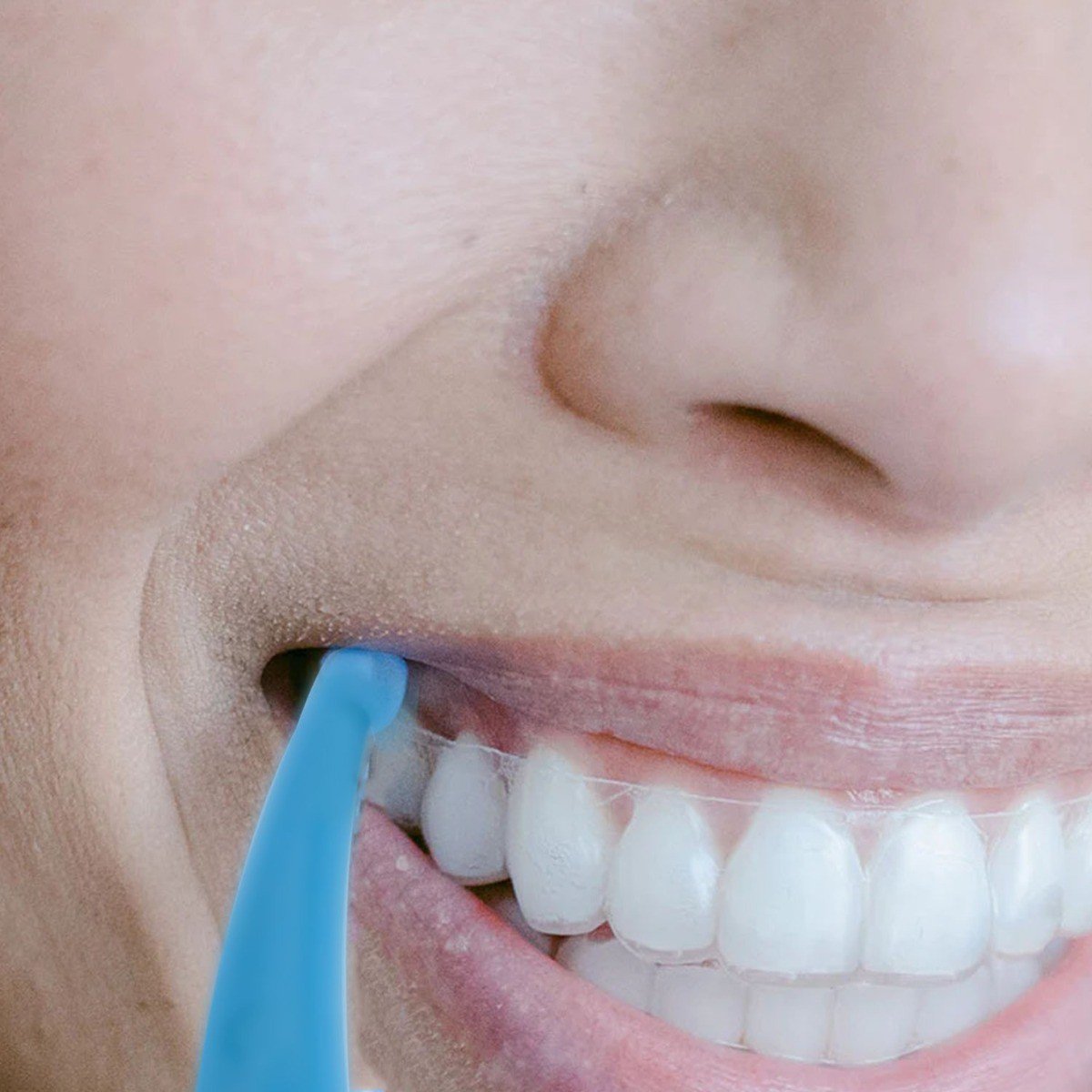 Light blue Captain Aligner Removal Tool from Captain Orthodontics, made of thermoforming material, designed for easy aligner removal.