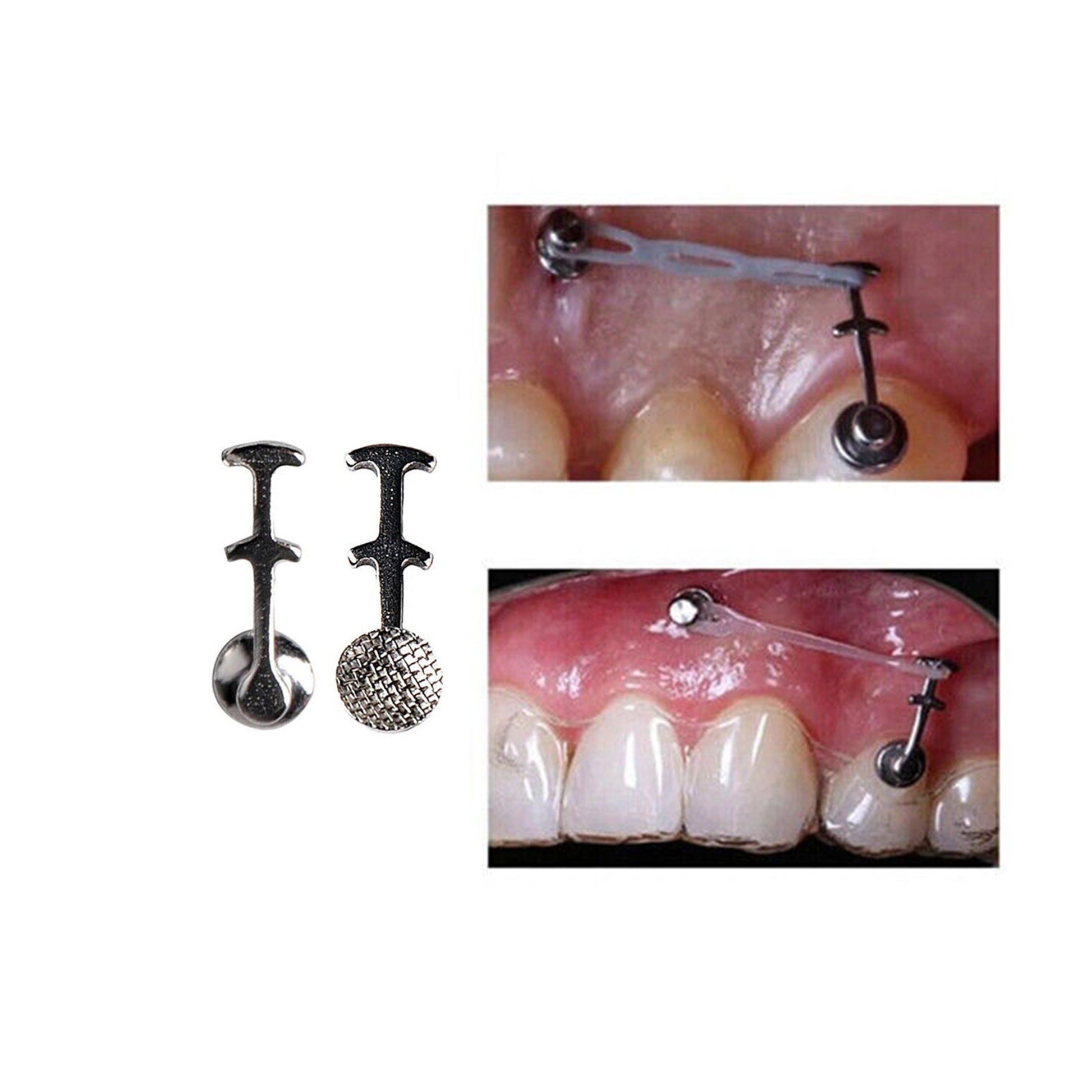 Captain Orthodontics Bondable Captain Multi Hook Button for orthodontic applications, shown in a close-up image.