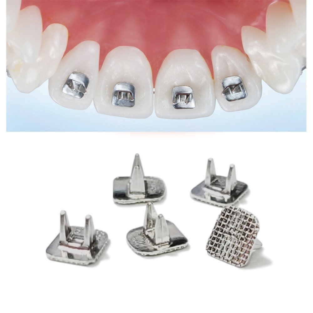 Captain Orthodontics Captain Tongue Tamers Bondable buttons for orthodontic treatment, shown in a close-up image.