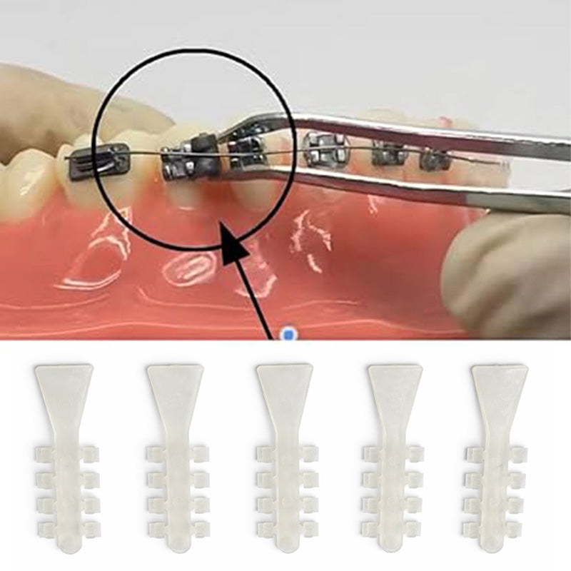 Clear Captain Rotation Wedges from Captain Orthodontics designed for precise tooth rotation and orthodontic adjustments.