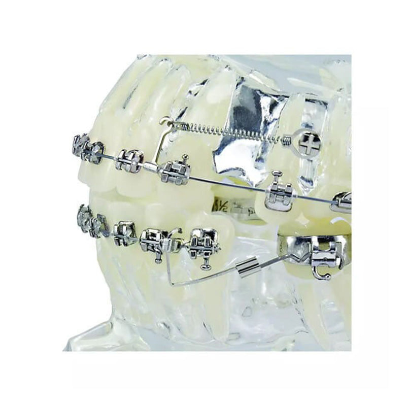 Captain Orthodontics Cross Tube .022" slot, 2.0 mm length, metal orthodontic tube used in dental braces.