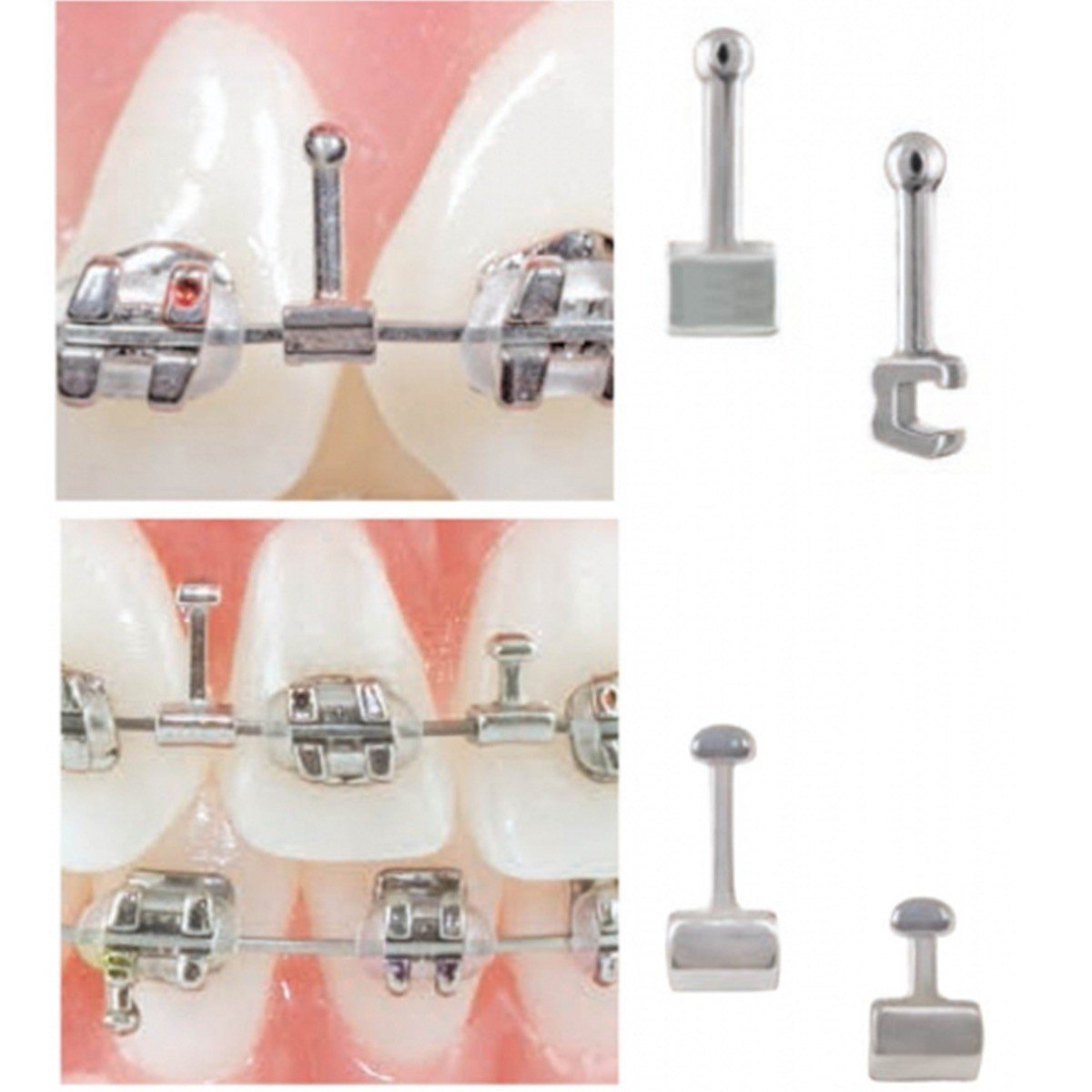 Captain Orthodontics weldable crimpable hooks 021 x 025, medium size, shown in a pack of 10 on a white background.
