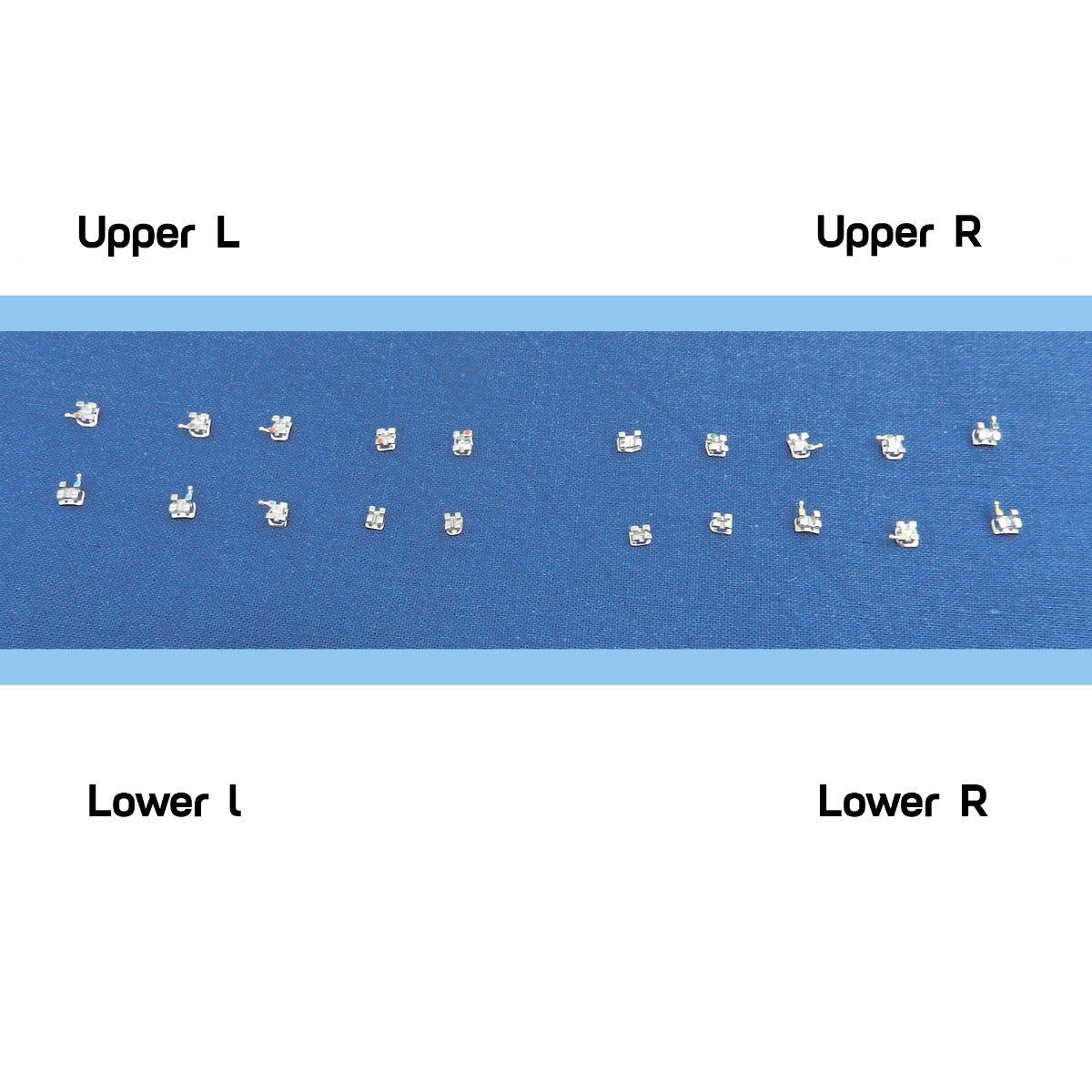 Set of 20 Centrino Roth MBT metal brackets, standard and mini sizes, for structural and assembly use.