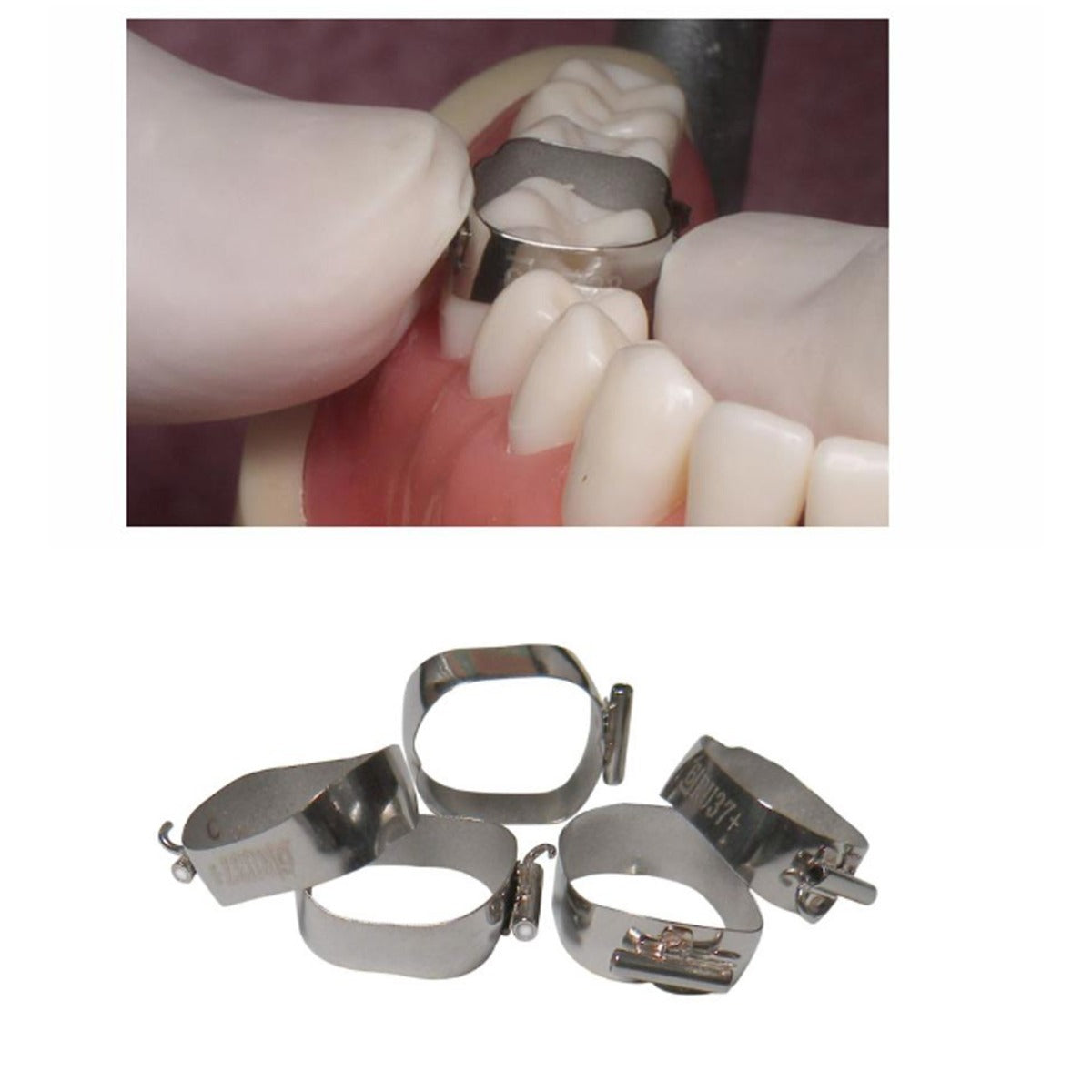 Centrino preformed molar bands with Beggs tube, upper right view, showing the metal band and attached tubing for orthodontic use.