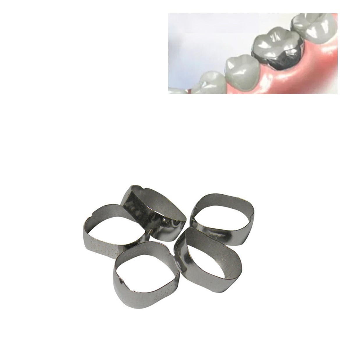 Centrino Plain Band molar orthodontic bands, 5-pack, preformed for upper right molars, orthodontic treatment accessory