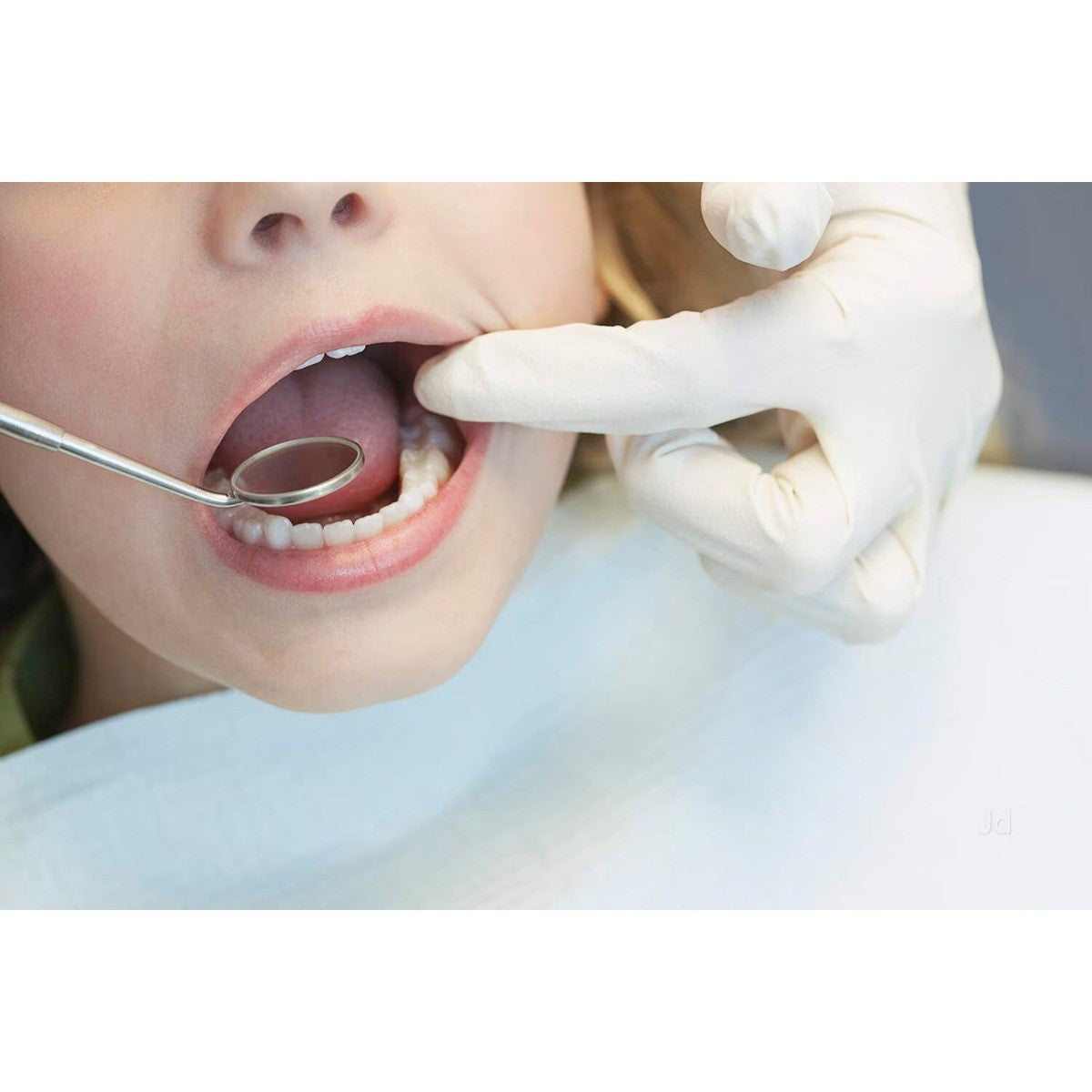 Hahnenkratt SE Plus Mouth Mirror, dental diagnostics tool with 22mm plane mirror, stainless steel handle for precise oral examinations.