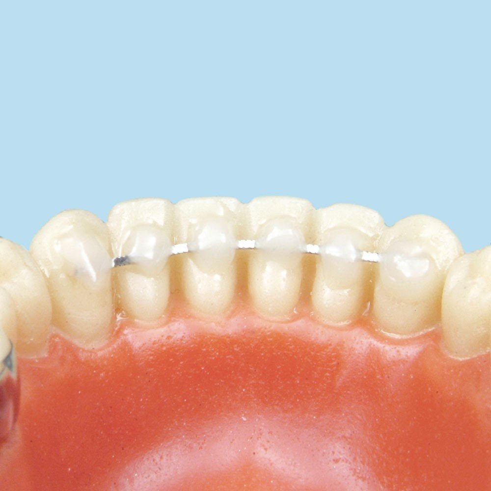 Leone S.p.a lingual retainer with flat woven wire for orthodontic support, designed for secure tooth retention and stability.