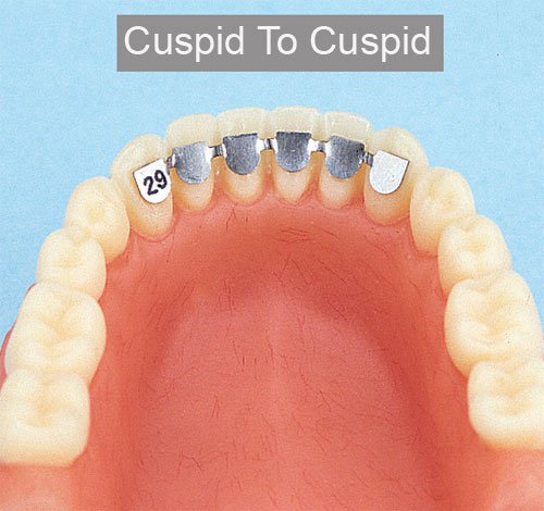 Leone s.p.a Lingual Retainer for lower cuspids, 37mm, single pack, designed for direct bonding to maintain teeth alignment.