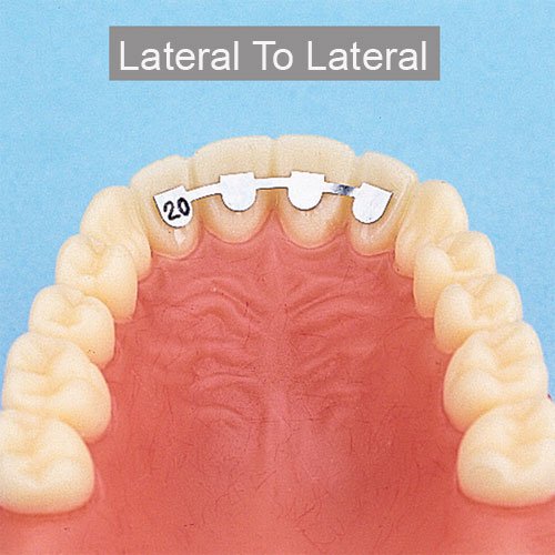 Leone s.p.a lingual bonding retainer for lower cuspid to cuspid, 37mm, designed for orthodontic retention and dental stability.