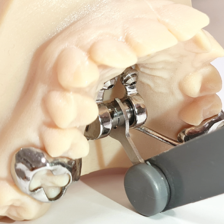 Leone Telescopic CAD-CAM Expander, a rapid orthodontic expander with 10mm expansion capacity, designed for dental orthodontic treatment.