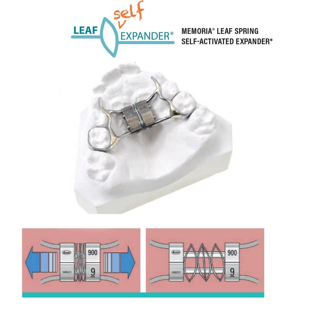 Leone Leaf Self Expander rapid orthodontic expander by Leone s.p.a, showing the screw mechanism and leaf design for dental expansion.