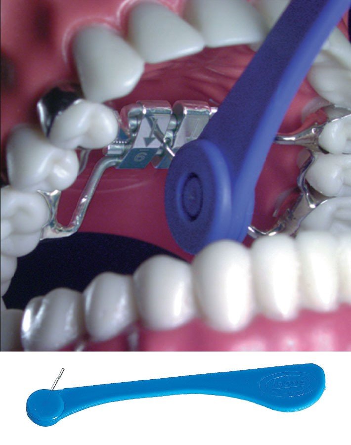 Leone S.p.a Rapid Expander Ragno Fan Type in 9mm, dental orthodontic appliance for expanding the palate or jaw.