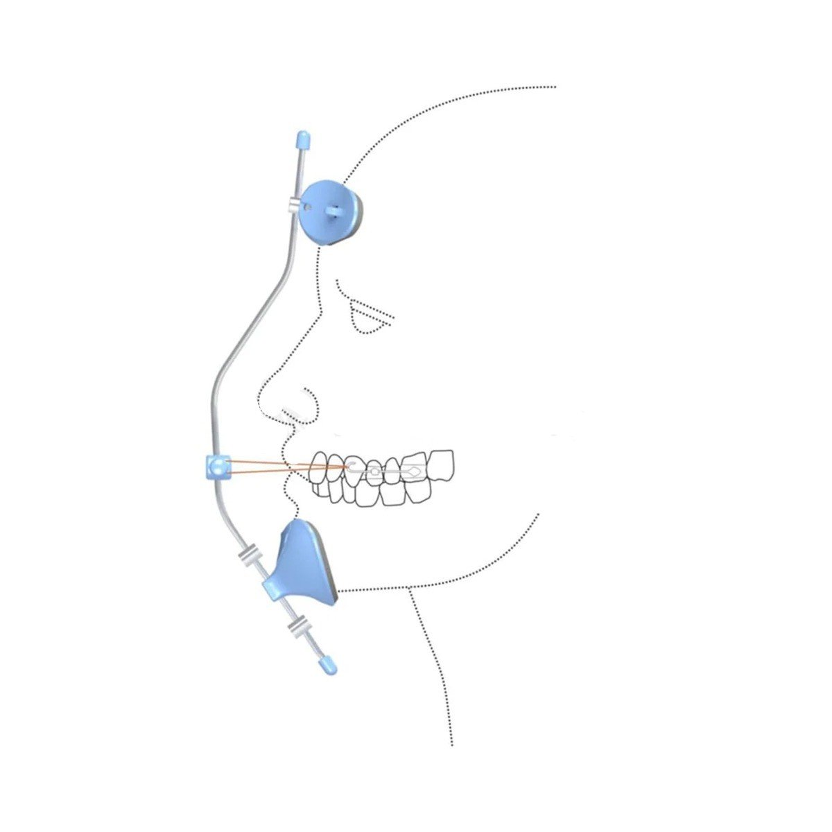 Pink Morelli Petit Facemask showing a soft fabric mask with ear loops, designed for comfortable facial coverage.