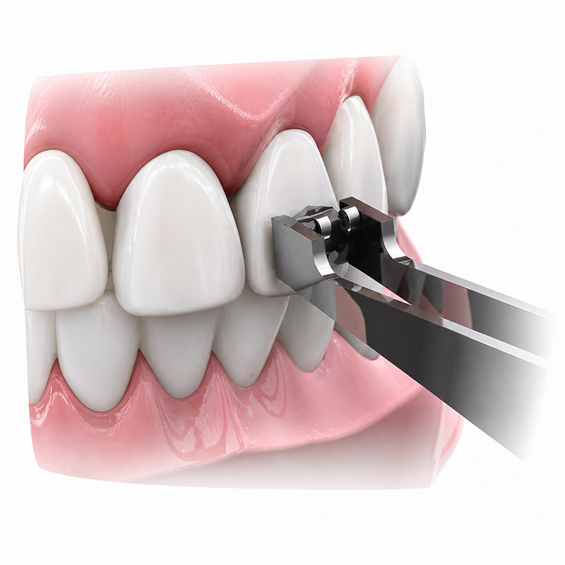 Morelli short tweezer for brackets with square tip, orthodontic forceps and tweezers for precise dental bracket placement.