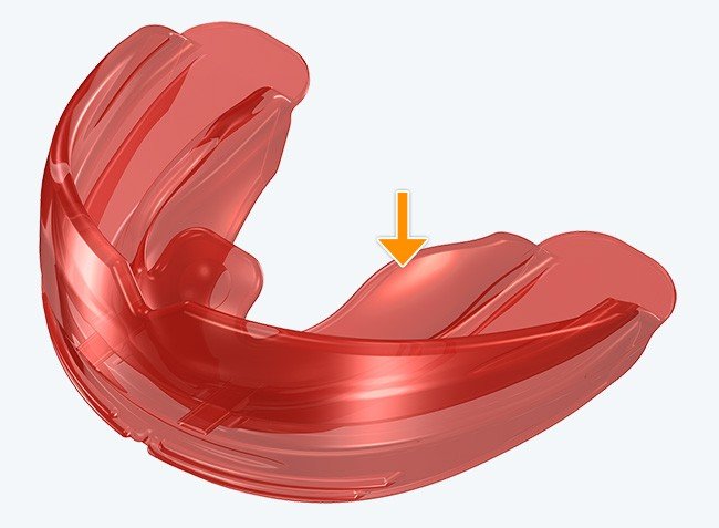 Red T4A Phase 2 MRC Trainer for alignment, a soft and hard appliance from Myofunctional Research Co. for orthodontic support.