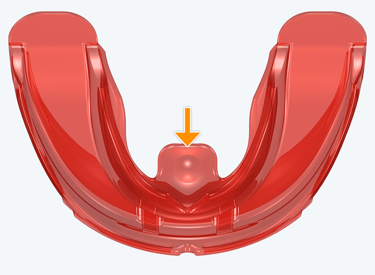 Myofunctional Research Co. T4A Phase 2 Hard Medium Red trainer appliance for dental alignment and jaw correction.