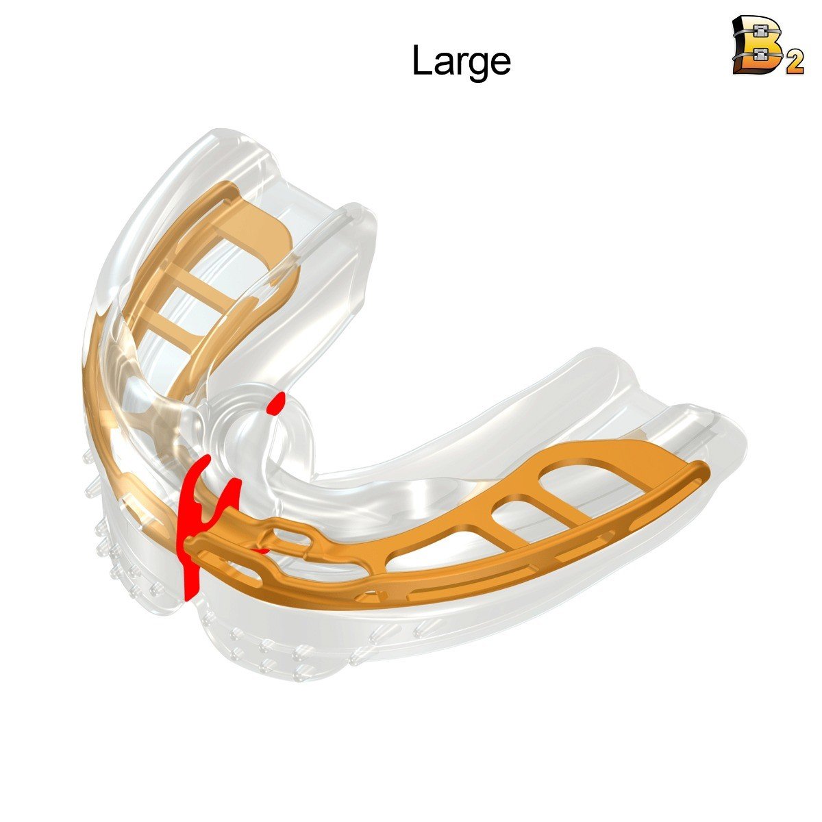 Clear Myobrace for Braces Stage 1 trainer appliance by Myofunctional Research Co. designed for orthodontic support.