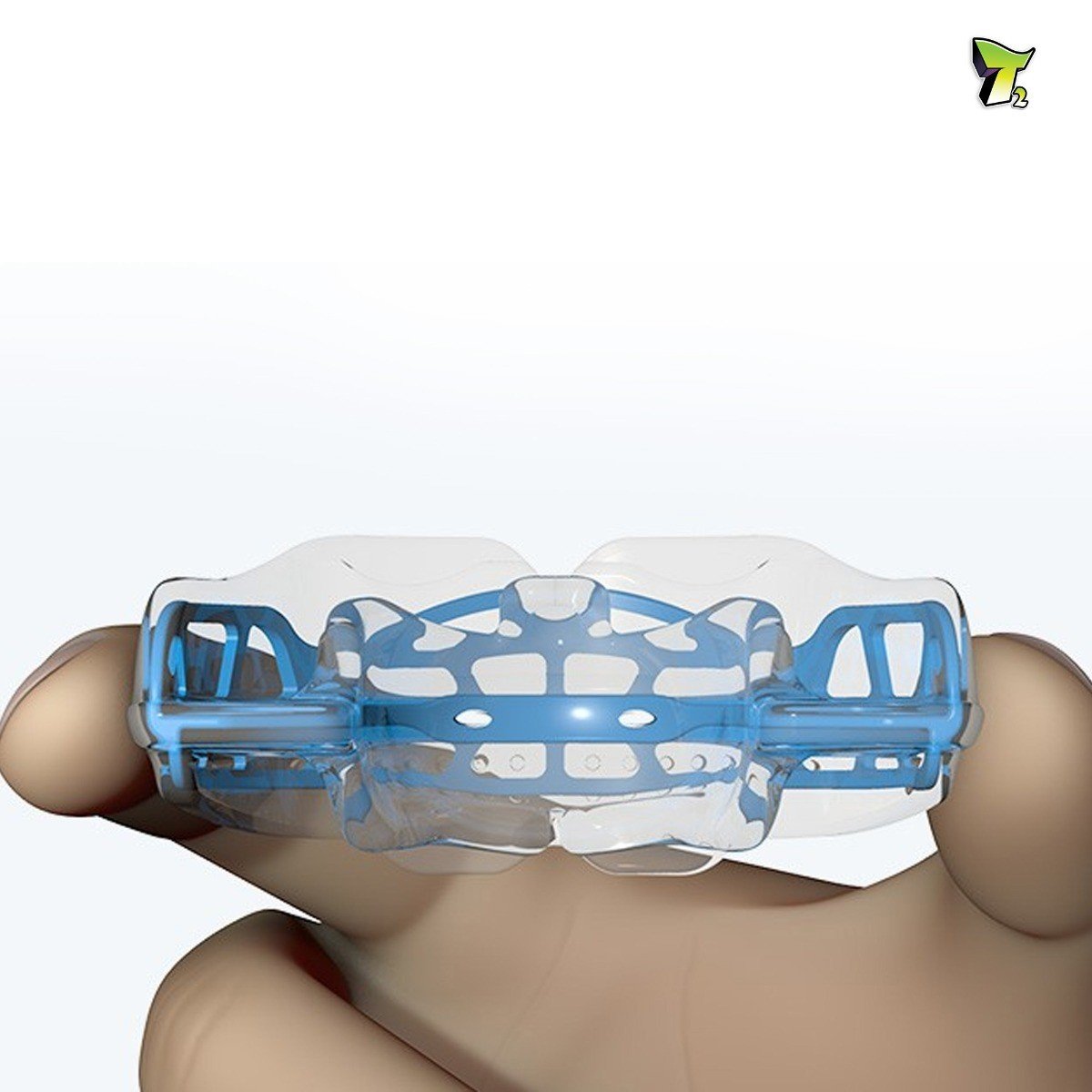 Blue MRC Myobrace trainer appliance for teens, stage 1, used for orthodontic and myofunctional therapy, by Myofunctional Research Co.