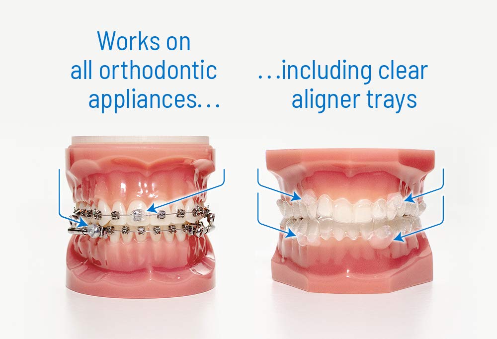 OrVance Ortho Dots Clear patient relief wax for dental appliances, shown on a white background, clear and discreet in appearance.