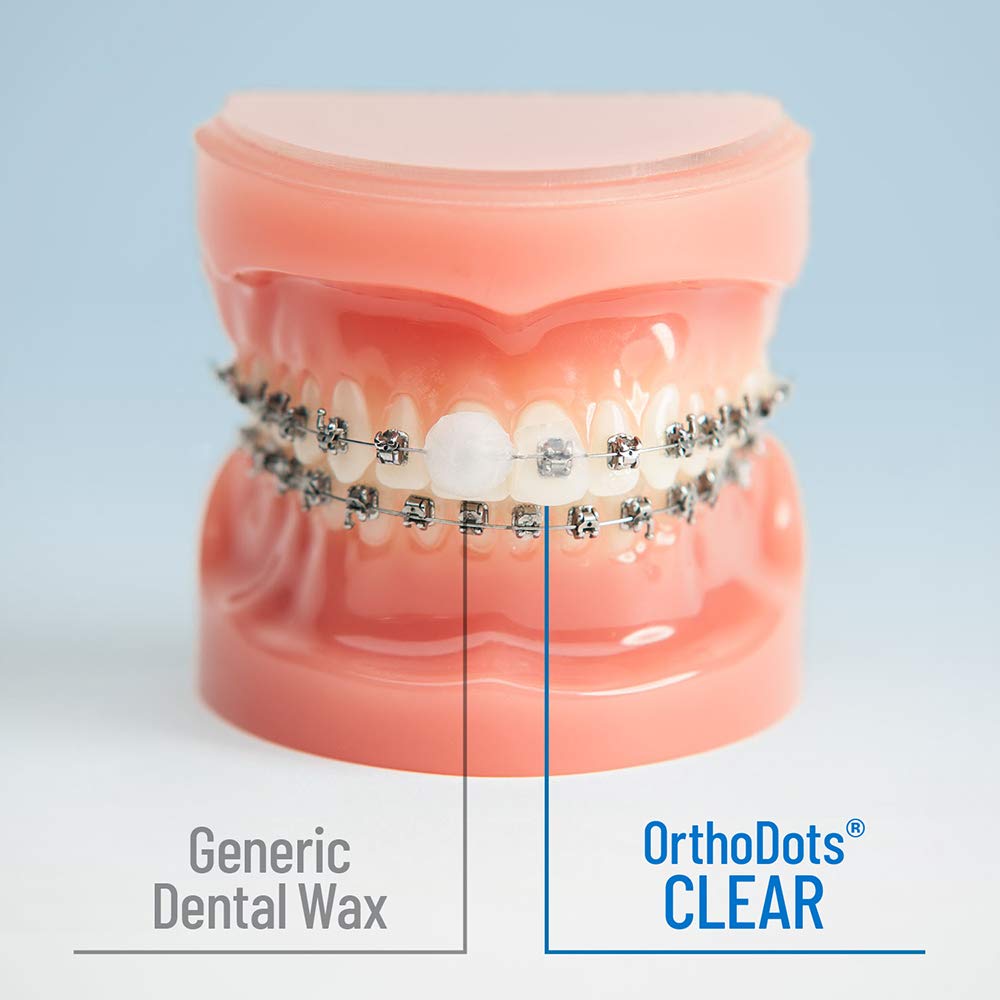 OrVance Ortho Dots Clear patient relief wax, discreet dental wax for orthodontic appliance comfort and protection.
