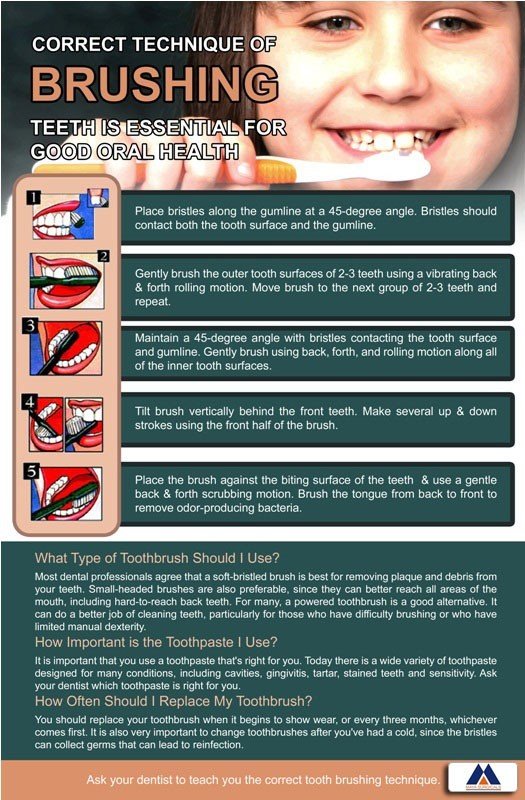 Poster English Correct Technique of Brushing - 039 - Libral Traders