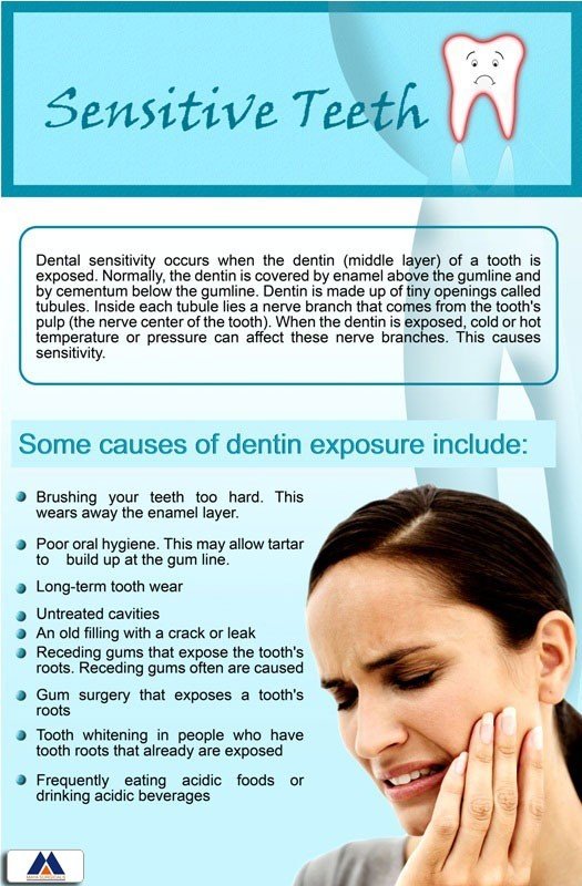 Poster English Sensitive Teeth - 043 - Libral Traders