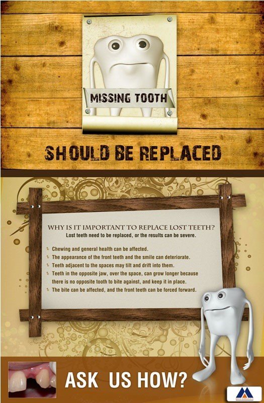 Poster English Missing Tooth Should Be Replaced - 048 - Libral Traders