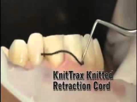 Pascal Knit-Trax knitted retraction cord showing its textured, flexible design for dental or medical retraction purposes.