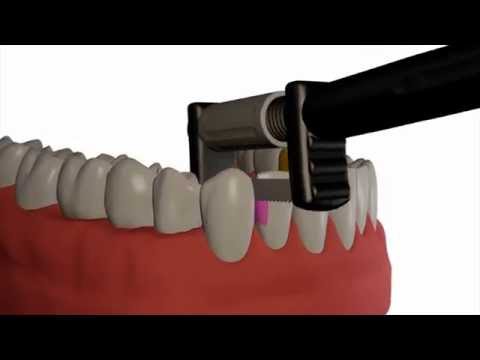 Load video: 