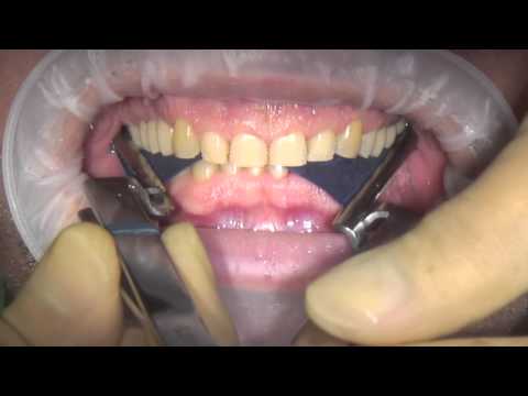 Load video: 
