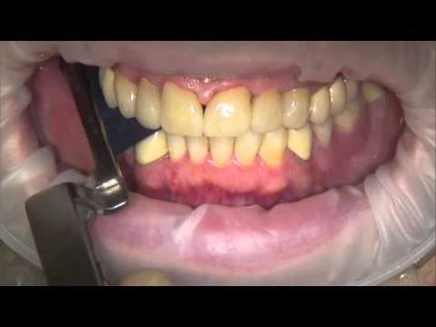 Load video: 