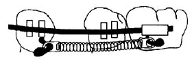Rabbit Force RF Niti closed coil springs with eyelets, 6mm length, durable compression springs for various applications.