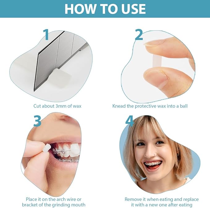 Rabbit Force RF Patient Relief Orthodontic Wax in mint flavor, 10-pack, for comfort and protection around braces and wires.