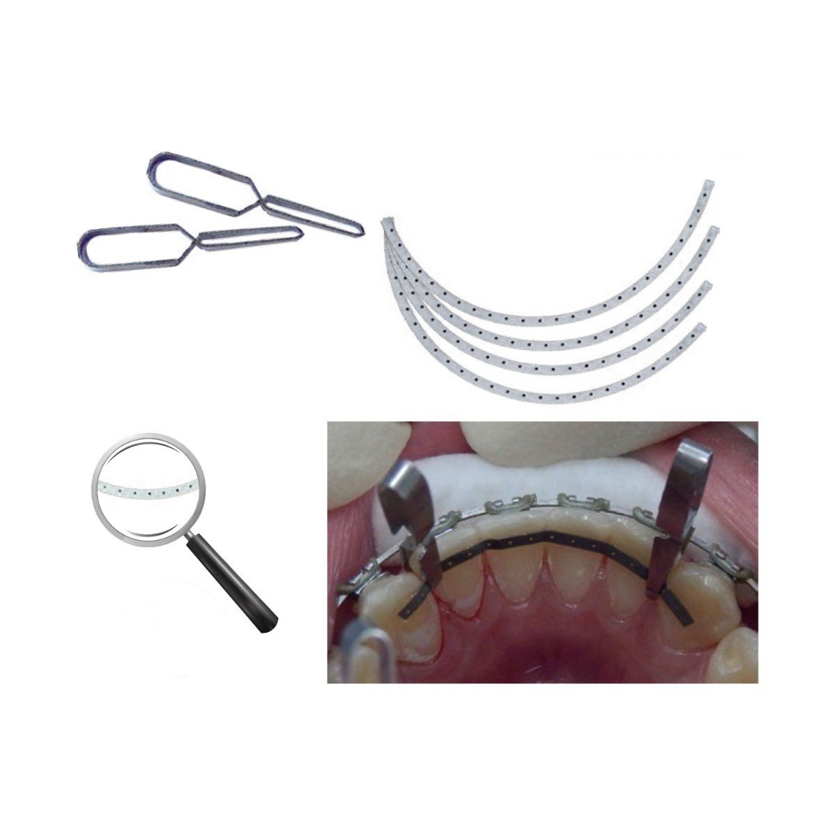 Strauss & Co Lingual Retention Wire Set with multiple small metal wires for dental retention, displayed on a clean background.